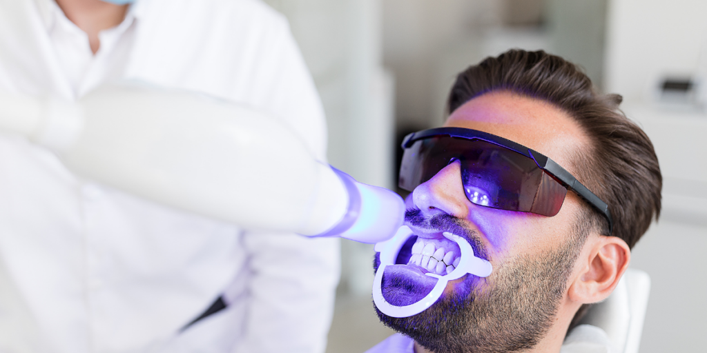 Blanqueamiento dental. Clínica dental Ceroi en Alcorcón