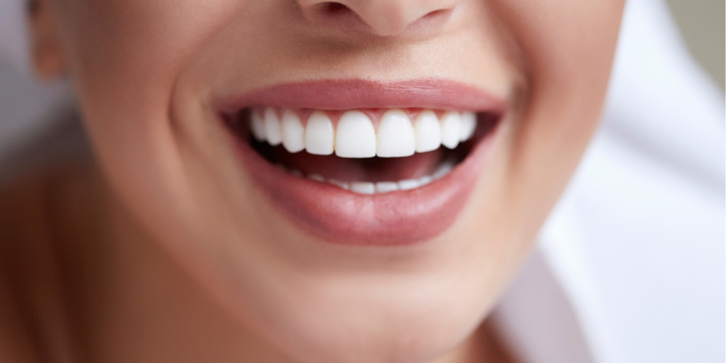 Mitos Blanqueamiento dental