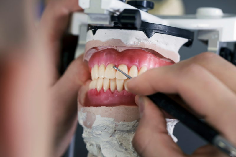limpieza dental